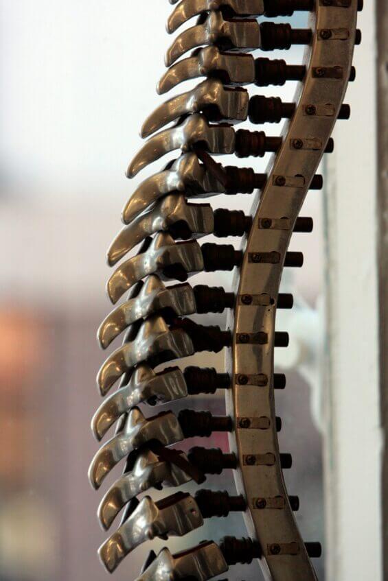 Carlsbad: Tapping into spinal innovation